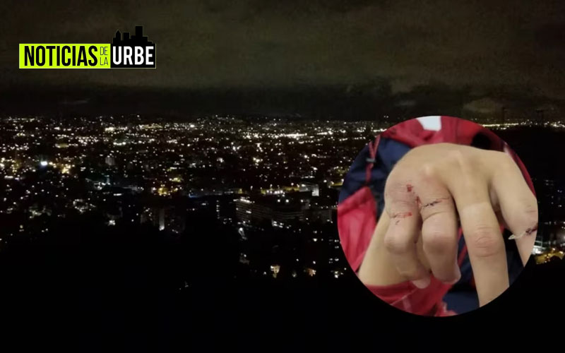 Conductor de noticiero de Bogotá fue agredido de un palazo para robarle